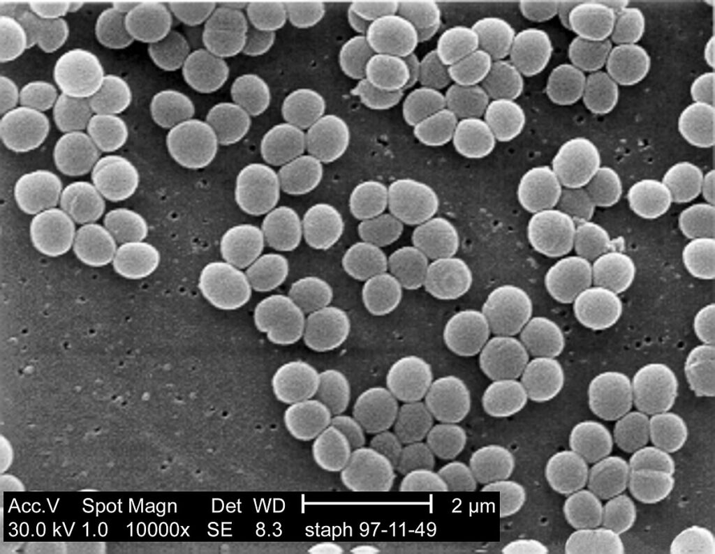 モラクセラ菌、イソ吉草酸を科学的に消臭する